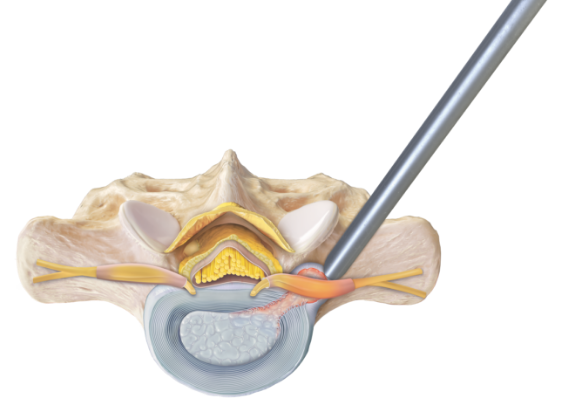 スリープAR スリープ【AR】{086/078}
